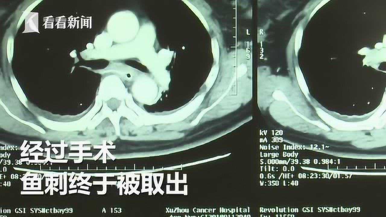 北岸初晴i 第7页