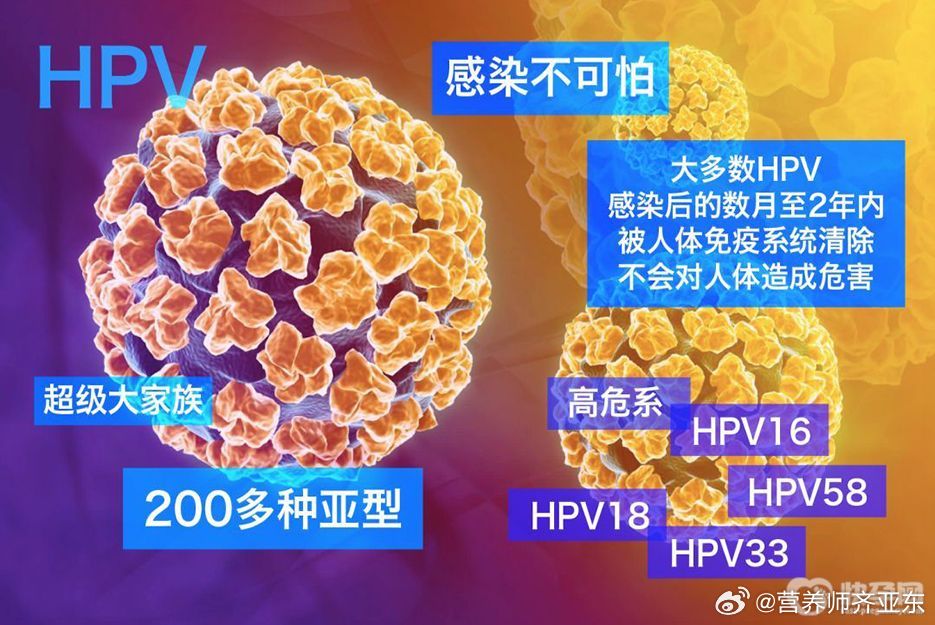 多数人感染HPV后两年内可自愈